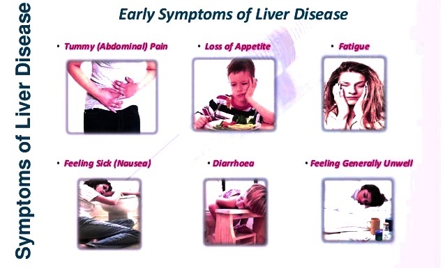Early Signs And Symptoms Of Liver Disease In Toddlers Recognize Disease